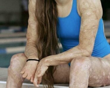 SOTD – Les conséquences du manque de sommeil : voyez par vous-même