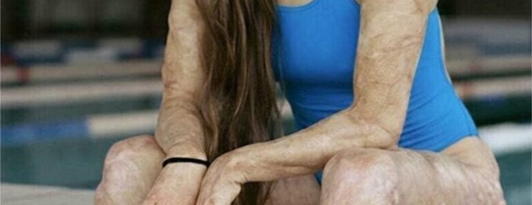 SOTD – Les conséquences du manque de sommeil : voyez par vous-même