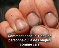 Ongles Sales : Négligence ou Marque des Métiers Manuels ? Décryptage d’un Préjugé Tenace