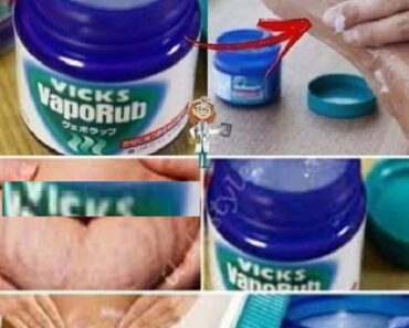 Les Utilisations Insoupçonnées du Vicks VapoRub : Au-Delà du Traitement des Symptômes Grippaux